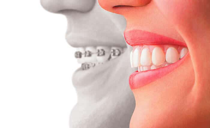 Cosmetic Dentistry in Thornhill Toronto